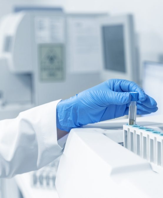 Female scientist analyzing covid-19 sample in the laboratory